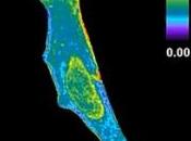 CANCER: Découverte d'une enzyme dissémination métastatique Journal Cell Biology