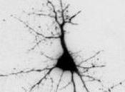 ALZHEIMER: l'accumulation d'amyloïde commençait Brain