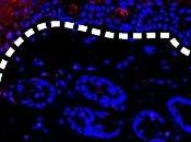 PLAIES DIABÉTIQUES: protéine ralentit cicatrisation sous l'effet sucre Journal Cell Biology