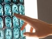 NEURO: cerveau contrôlait propre perte? Translational Vision Science Technology