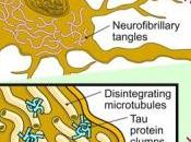 ALZHEIMER: Réduire cholestérol cerveau pour normaliser Inserm Human Molecular Genetics