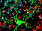 SCHIZOPHRÉNIE: anti-inflammatoires pour prévenir? American Journal Psychiatry