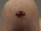 CANCER: seule goutte sang pour identifier l'origine tumeur Cancer Cell