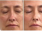 Offre Noël soin visage