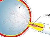 #thelancetneurology #névriteoptique #phénytoïne #neuroprotection Phénytoïne neuroprotection chez patients atteints névrite optique essai phase randomisé contrôlé placebo