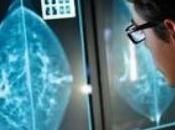 CANCER SEIN: gène alcoolisé déclenche risque PLoS