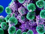 INFECTIONS NOSOCOMIALES: L'anti-biofilm nano repousse bactéries Advanced Materials Interfaces