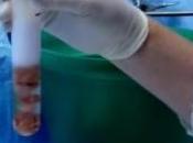 DÉMENCE: c'était fait d'un système immunitaire inné déréglé? Frontiers Neuroscience