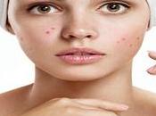 L'alimentation pour lutter contre l'acné (vidéo)