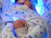 ICTÈRE nouveau-né: photothérapie accroît-elle risque cancer pédiatrique? Pediatrics