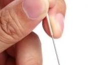 ACUPUNCTURE DÉCLIN COGNITIF: aiguille contre perte mémoire? Acupuncture Medicine