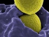 INFECTION PLAIES: Evitons bactéries trop s'attacher cellules PLoS