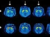 COCAÏNE: long chemin vers vaccin anti-addiction Vaccination