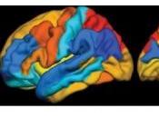 PET: L'imagerie repousse frontières dans compréhension l'Alzheimer Brain