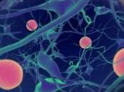 PARKINSON: promesses caféine Chemical Neuroscience