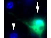 PARKINSON: virus cérébral fait passer maladie Science