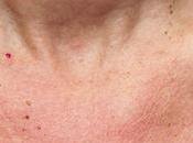 bien preparer peau soleil