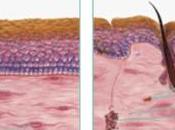 PLAIES CHRONIQUES derme artificiel bascule génome plaie vers cicatrisation Science Translational Medicine