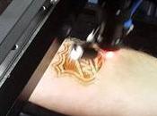TECHNICART Tattoos Laser