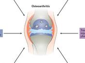 ARTHROSE Pour l'éviter, exercice alimentation équilibrée Nature Reviews Rheumatology