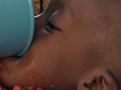 [VIDÉO] Somalie nombre d’enfants doublé dans centres nutritionnels Baidoa Kismayo