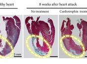 CARDIO Faire croire coeur qu’il fait l’exercice