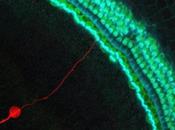 SURDITÉ injection cellules souches dans l'oreille pour restaurer l’audition