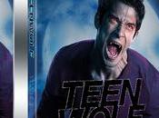 [Test DVD] Teen Wolf Saison partie série