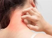 ECZÉMA traiter peut endiguer marche atopique