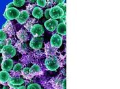 MUCOVISCIDOSE infections biofilm L’antibactérien dentifrice combat maladies pulmonaires sévères