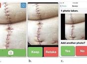 PLAIE POST-OP L’app télésurveillance domicile cicatrisation