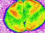 CANNABIS mais comment réduire effets cognitifs négatifs