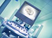 SCLÉROSE PLAQUES neuroréhabilitation Cadrer rôle pratique l’exercice