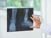 FRACTURE CHEVILLE: Déterminer stabilité demeure dilemme diagnostique