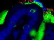 MICROBIOME NOURRISSON détermine risque d’allergie alimentaire