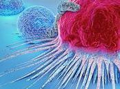 CANCER nouveau système optique détecte minuscules tumeurs