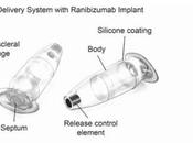 DMLA humide réservoir thérapeutique implanté plutôt injections répétées