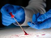 CANCER SEIN test sanguin simple pour détecter avant