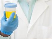 CANCER PROSTATE home test urinaire diagnostique avant