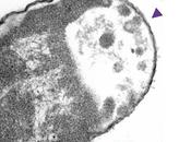 ANTIBIORÉSISTANCE nanomachines motorisées percent superbactéries