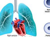 HYPERTENSION ARTÉRIELLE PULMONAIRE mauvaises bactéries intestinales dans poumons