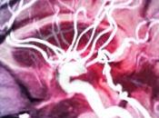 ALZHEIMER antioxydants pour retarder déclin cognitif