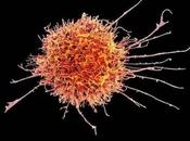 LEUCÉMIE Booster cellules tueuses naturelles, c'est possible