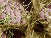 DRÉPANOCYTOSE rôles clés stress microbiote intestinal