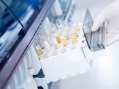 CANCER VESSIE biopsie liquide urinaire plutôt cytologie