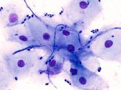 MICROBIOTE champignons éduquent réponse immunitaire