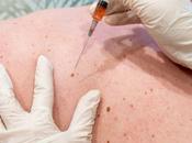 CANCER PEAU seule injection pourrait suffire