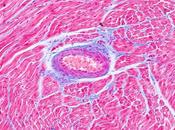 BOISSONS ÉNERGISANTES Elles agitent cardiomyocytes