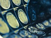COVID-19 baisse préoccupante hospitalisations pour urgences neurologiques
