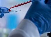 NEURODÉGÉNÉRESCENCE simple test sanguin peut détecter